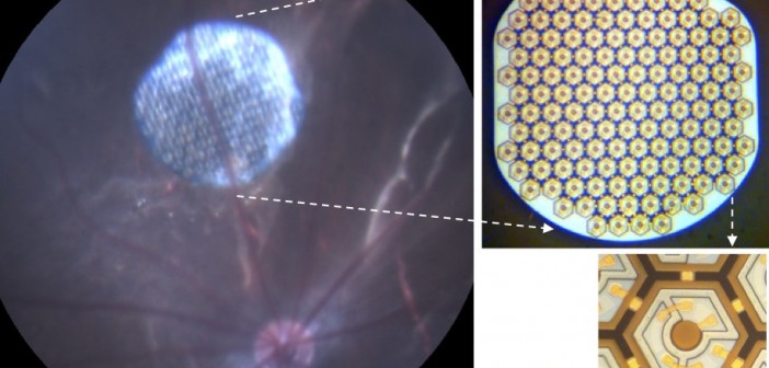 panou solar implantabil