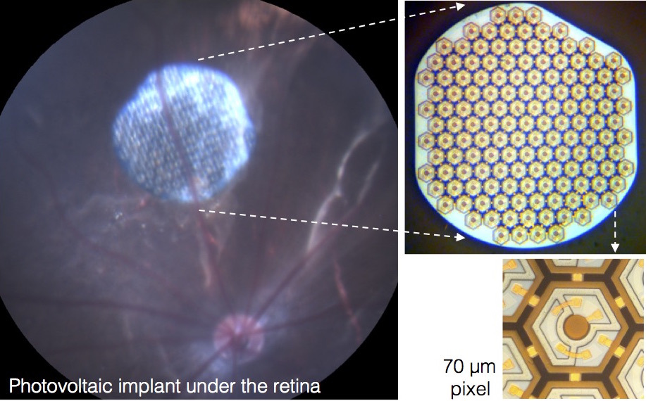 panou solar implantabil